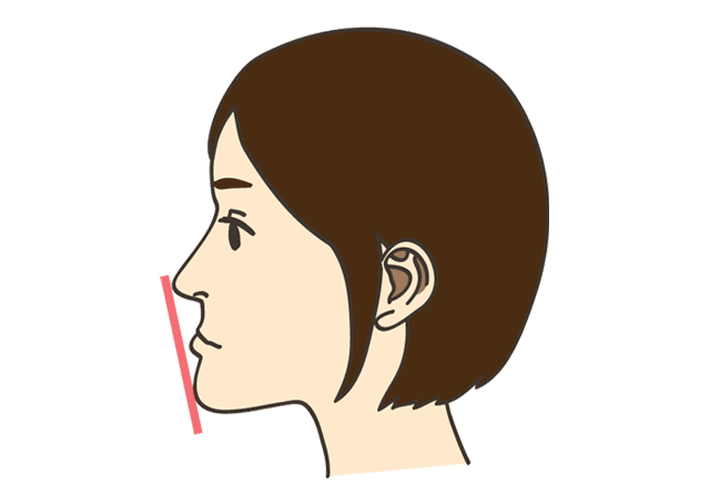 下顎前突（かがくぜんとつ）～受け口・しゃくれ～　いしはた歯科クリニック